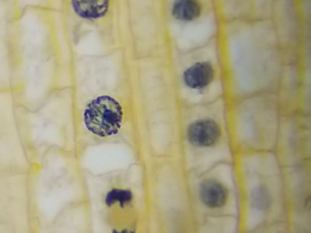 Onion Root Mitosis Slides - Onion Root  Mitosis 13 400X